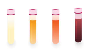 test tubes