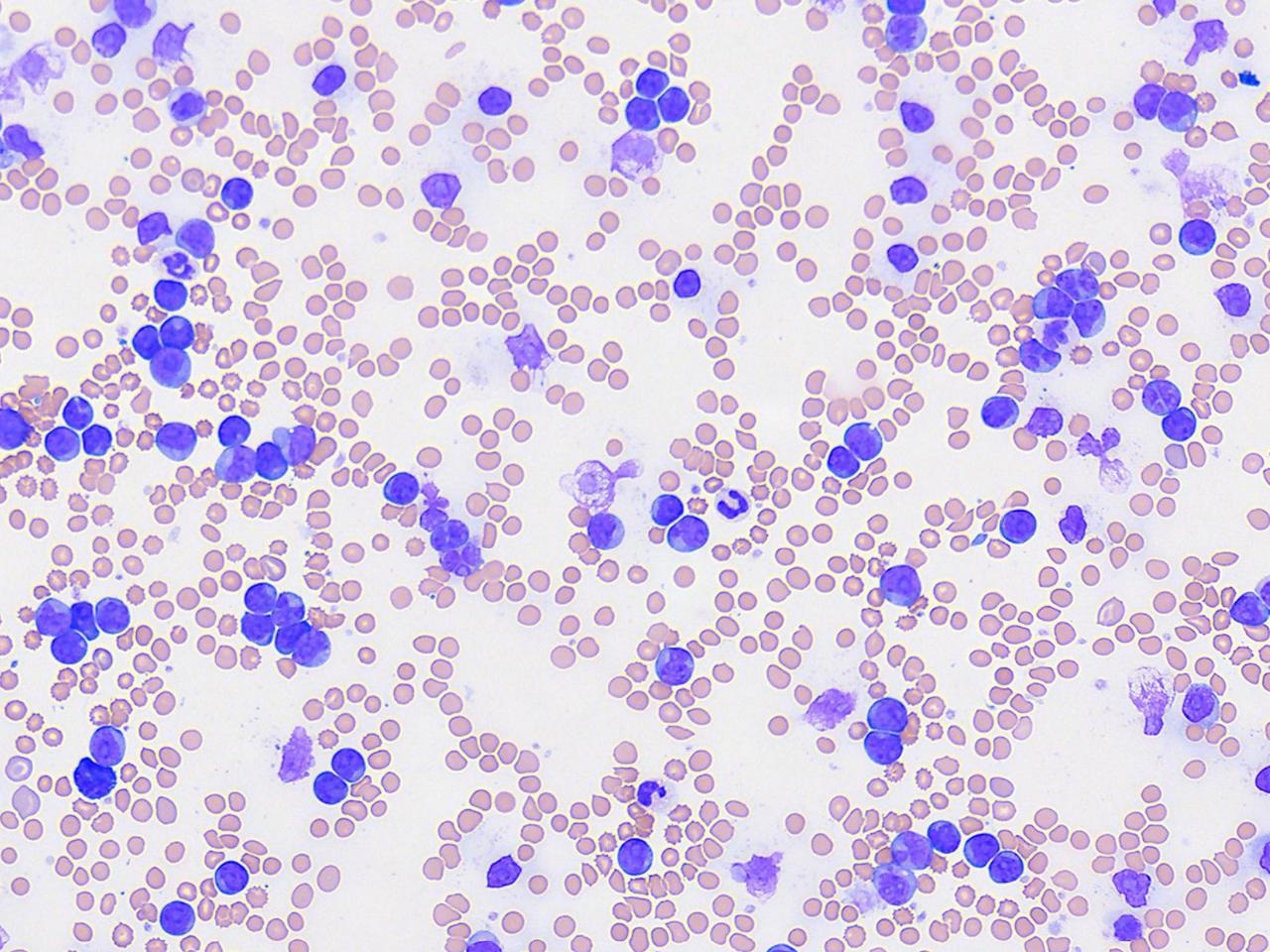 Hematology in the Point-of-Care Lab